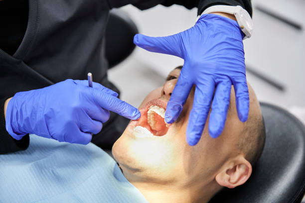 Best Emergency Dental Care for Sports Injuries in USA